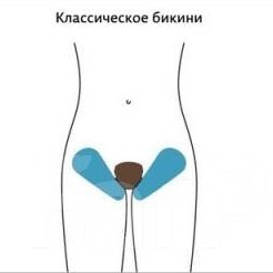 депиляция бикини (классика)