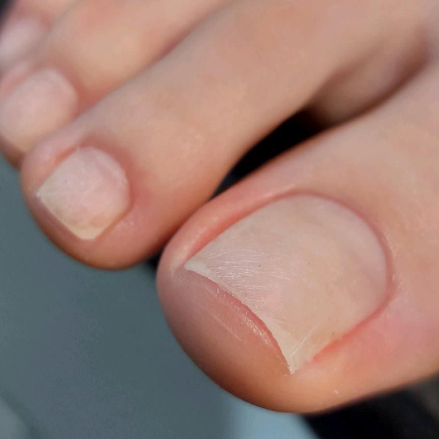 Педикюр Аппаратный