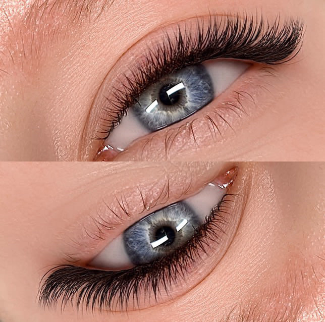 2.5/3D Correction/ Refill