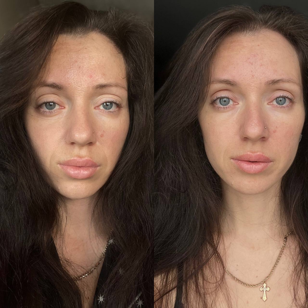 Пластический массаж лица