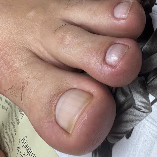 Педикюр гигиенический мужской