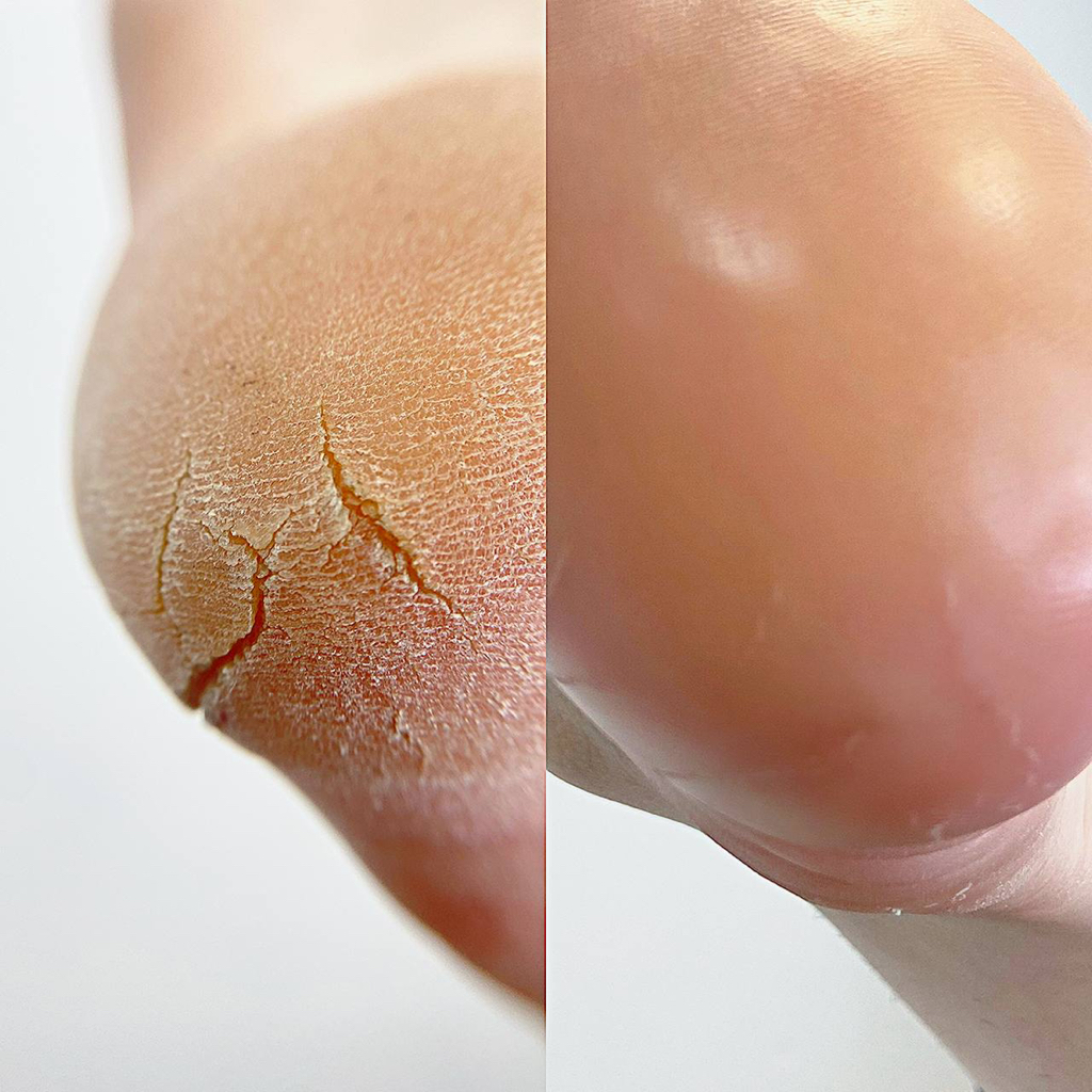 Педикюр (только стопы)