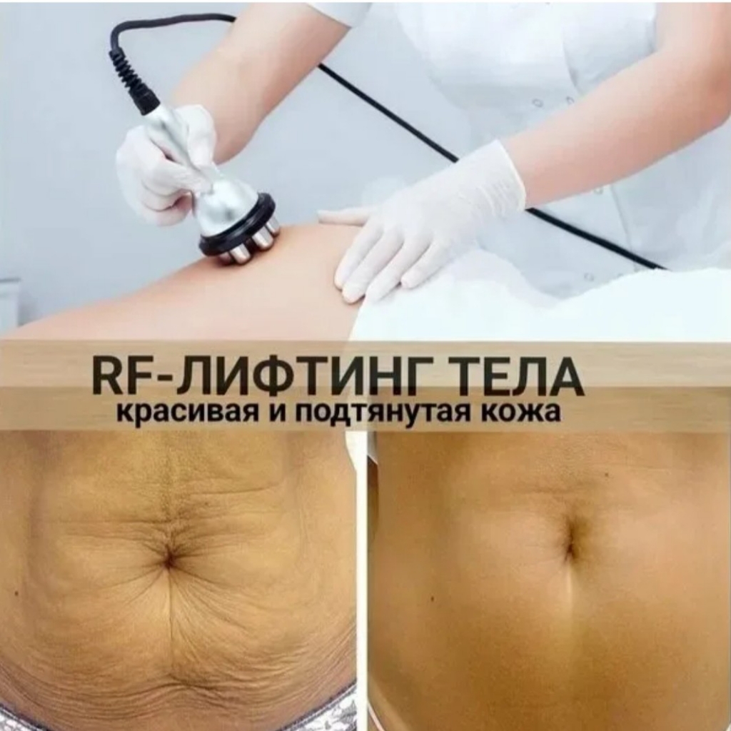 RF лифтинг  тела