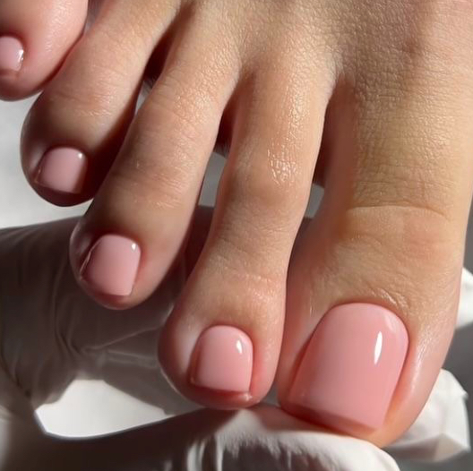 Удаление мазолей/натоптышей (1 единица)