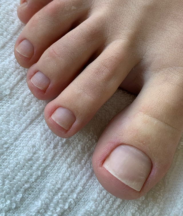 #13 Woman`s hygienic pedicure (feet & nails cleaning) / Hygiënische pedicure voor vrouwen (voeten en nagels reinigen)