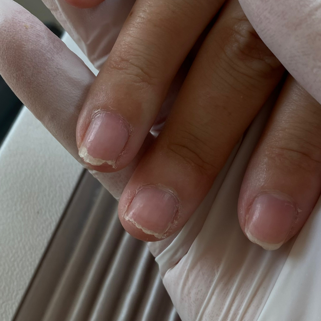 Woman’s medical manicure / Medische manicure voor vrouwen