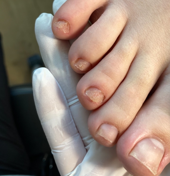 Women's medical pedicure/ Medische pedicure voor vrouwen