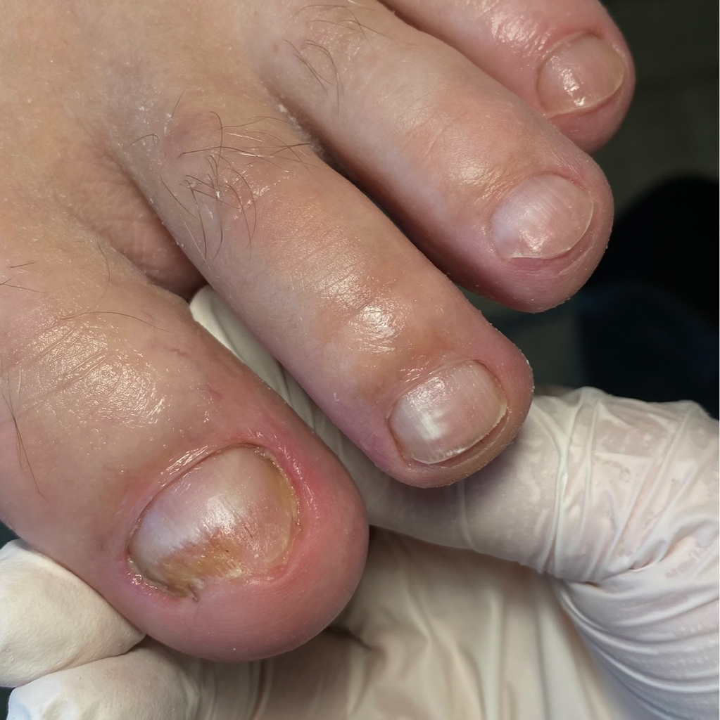#18 Men's medical pedicure 1 hour /Medische pedicure voor mannen 1 uur