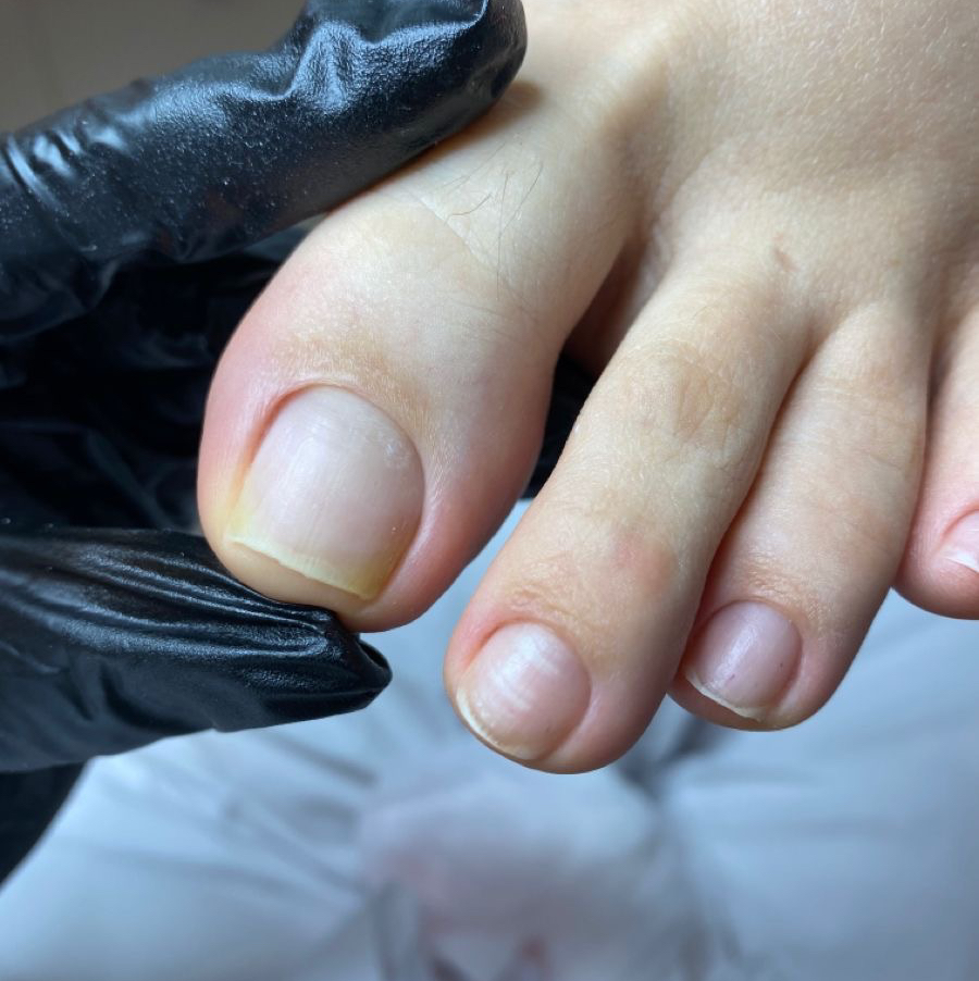 Педикюр. Снятие покрытие