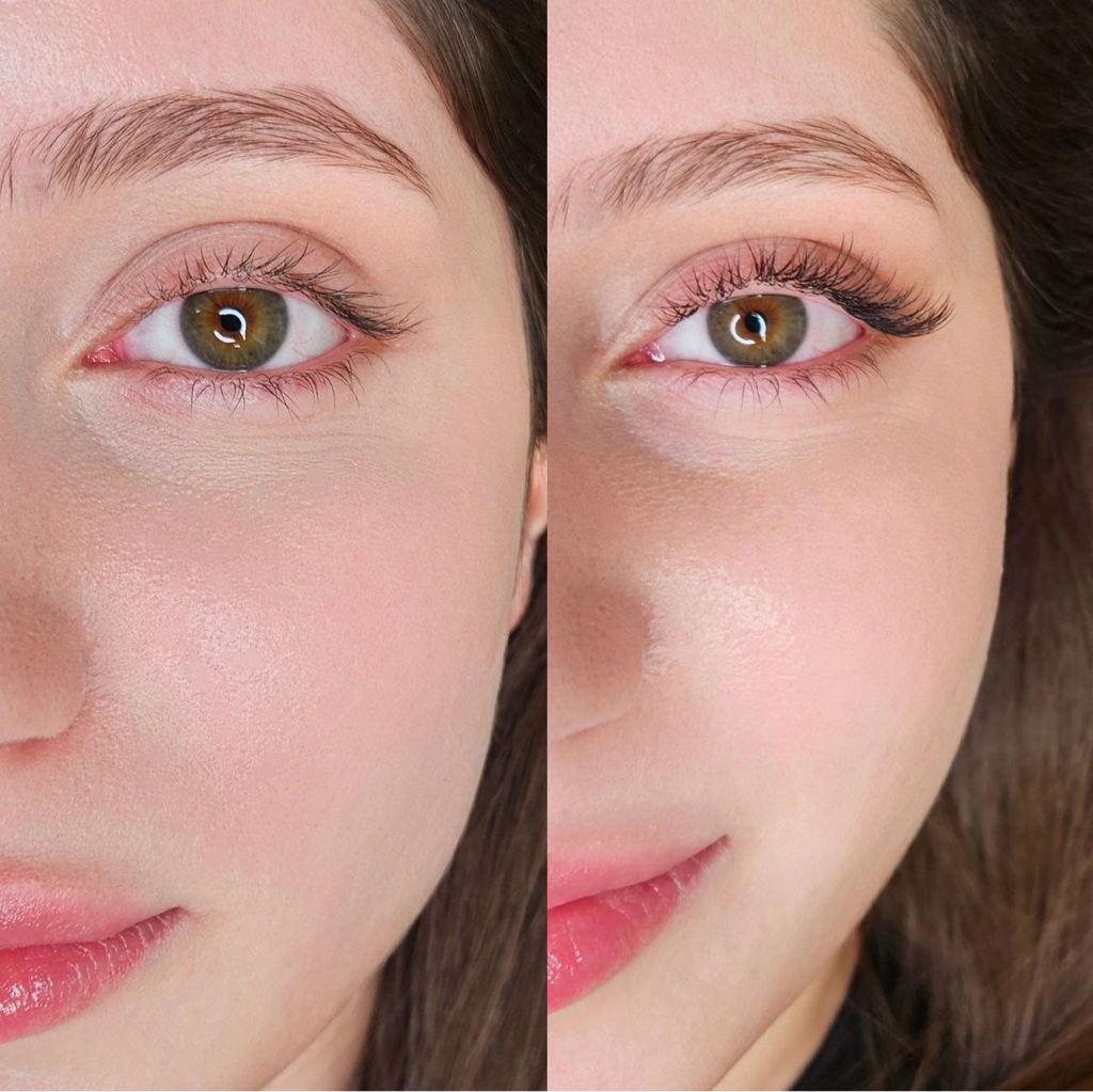 Адаптивное наращивание