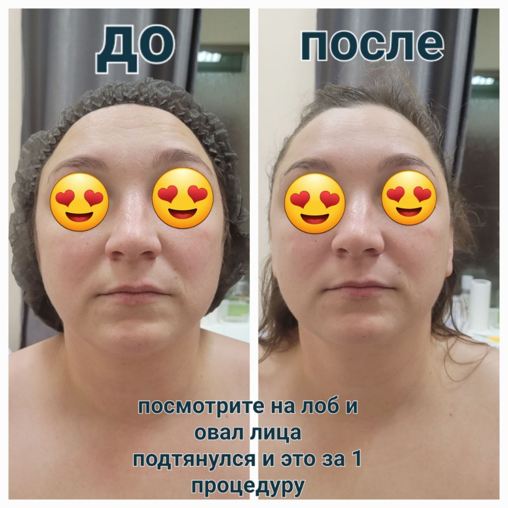 сеанс по лицу