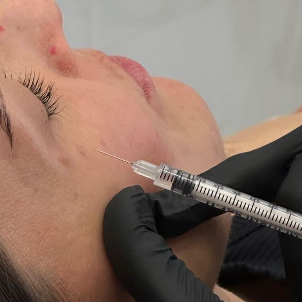 Мезоботокс монако