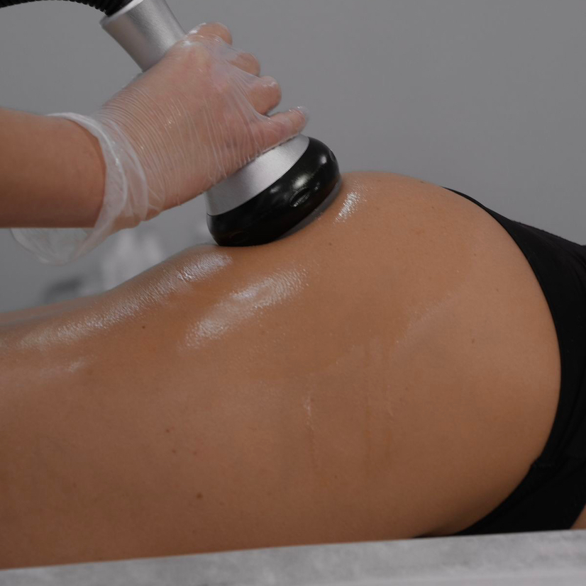 Вакуумный массаж