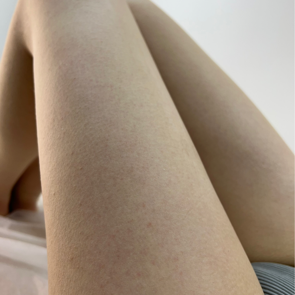 Голень /бедро