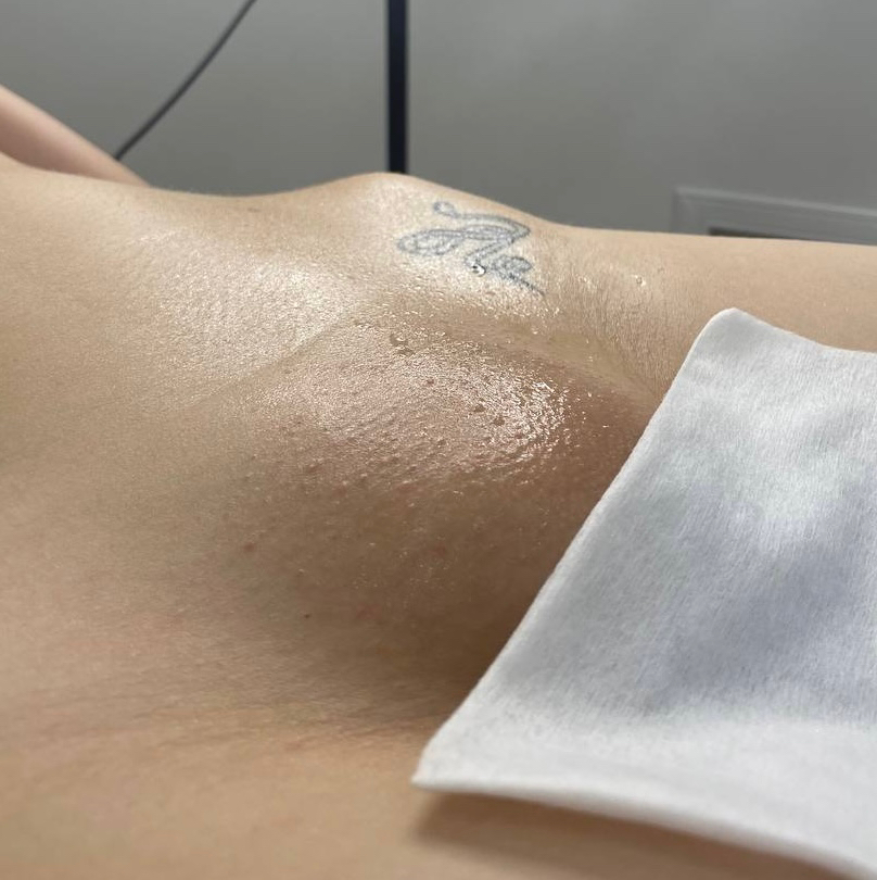 Бикини + подмышки + ножки + ручки