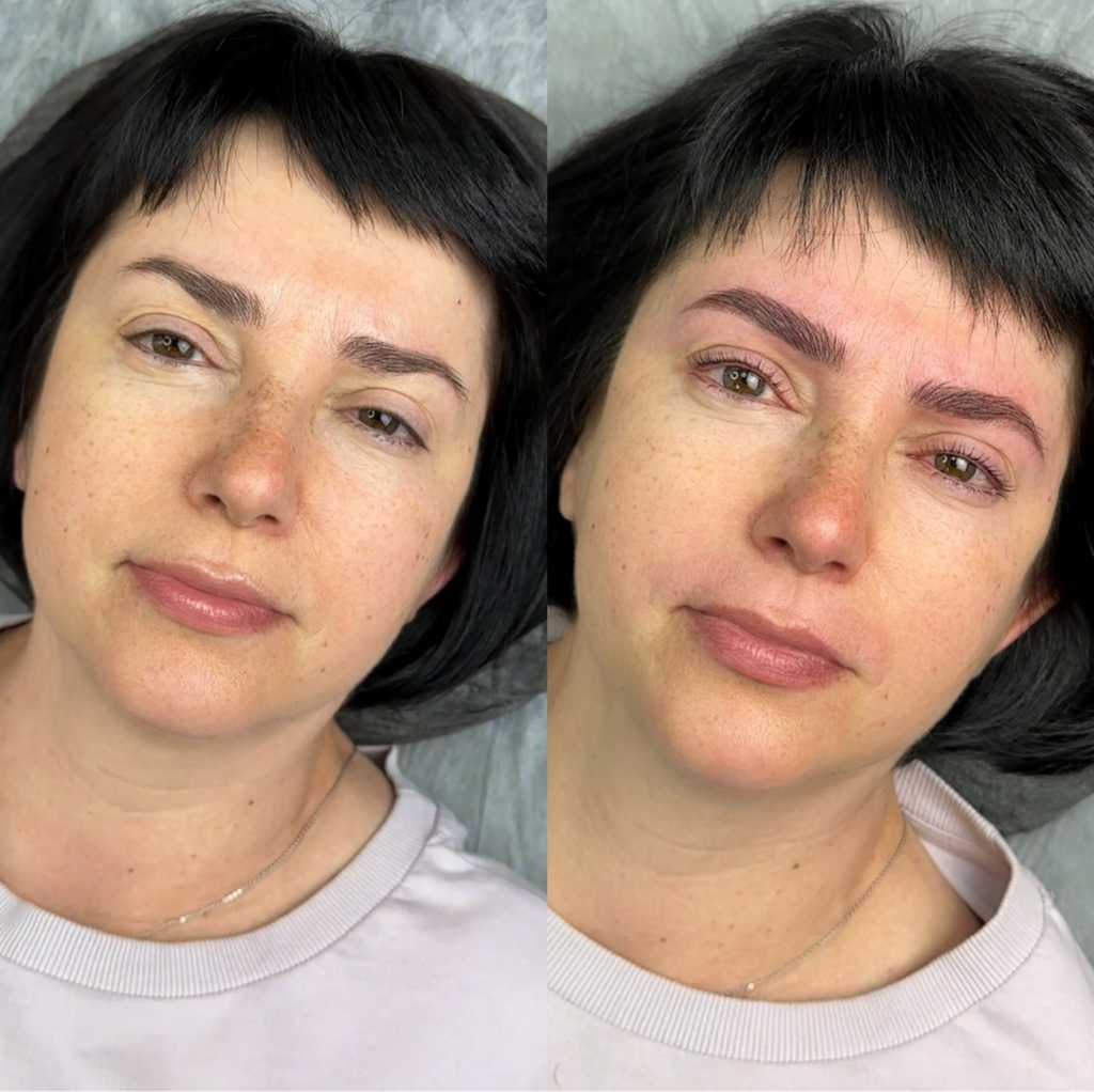 Комбо «Коррекция»