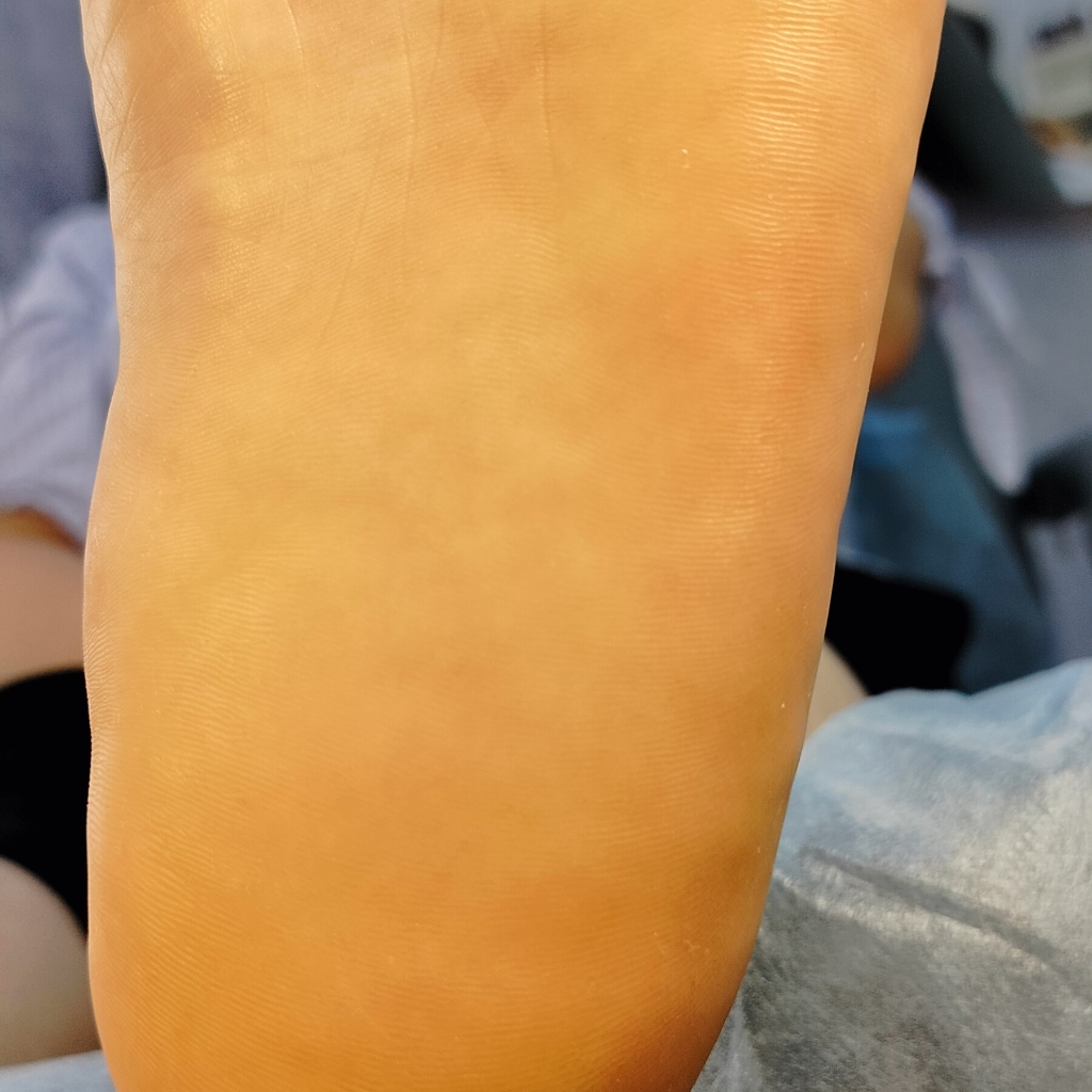 Педикюр мужской