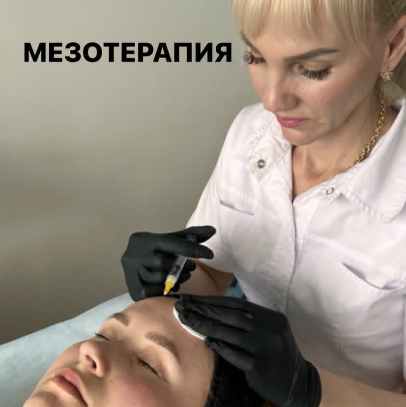 Мезотерапия лица