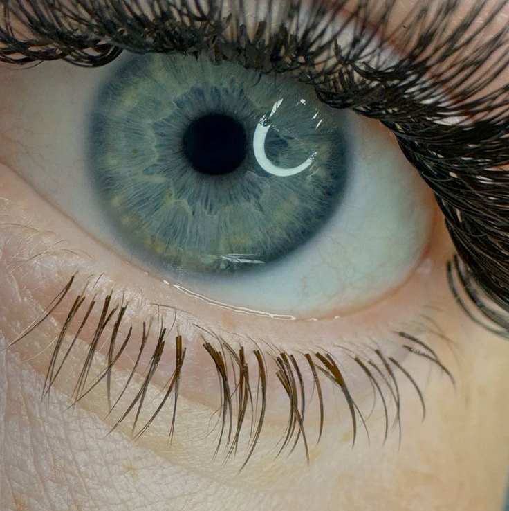 Нижние ресницы