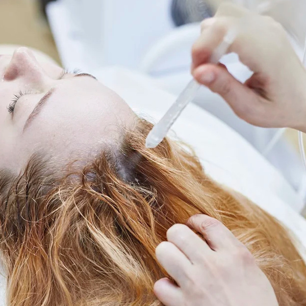 Газожидкостный пилинг кожи головы