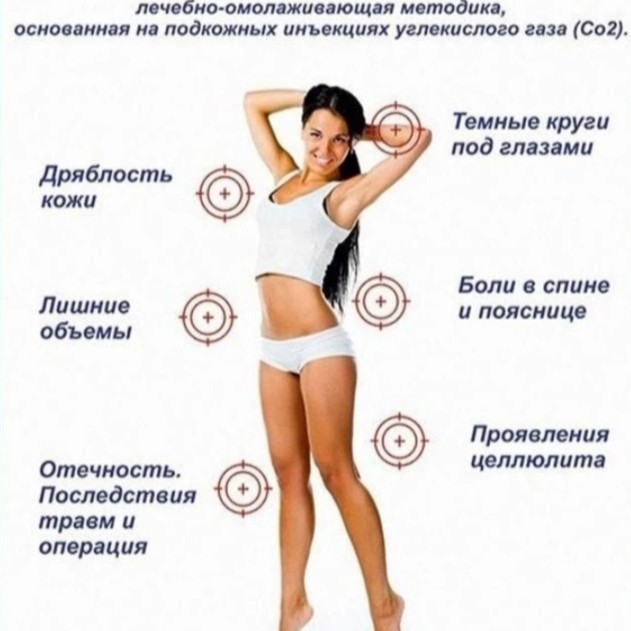 Карбокситерапия