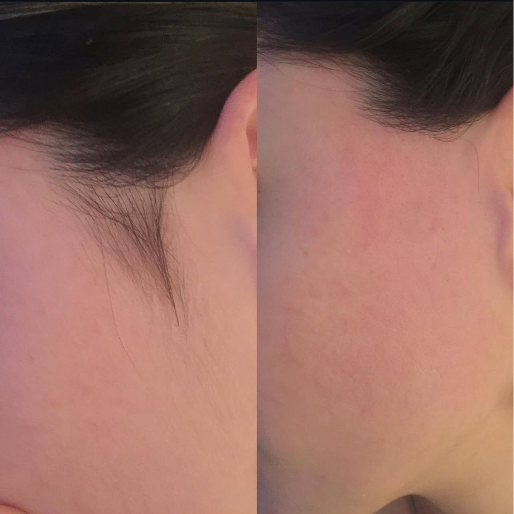 Бакенбарды