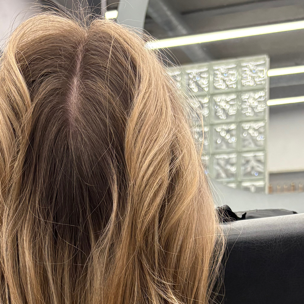 Пилинг кожи головы