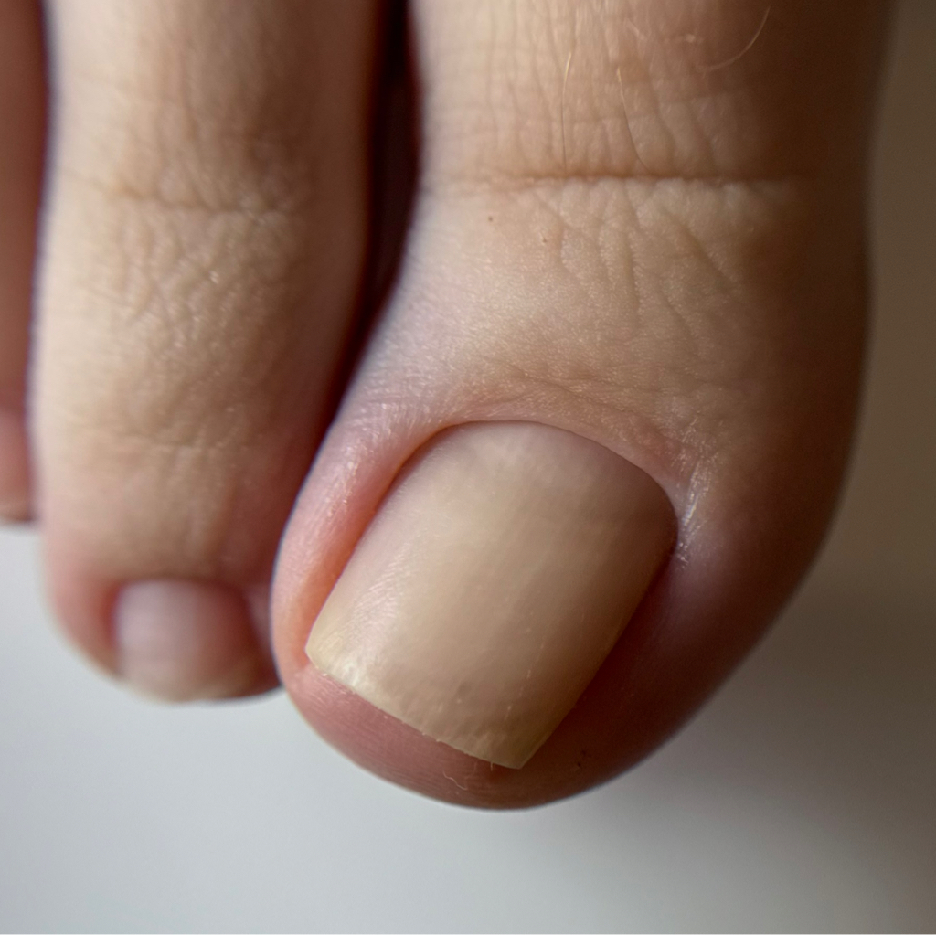 Гигиенический педикюр