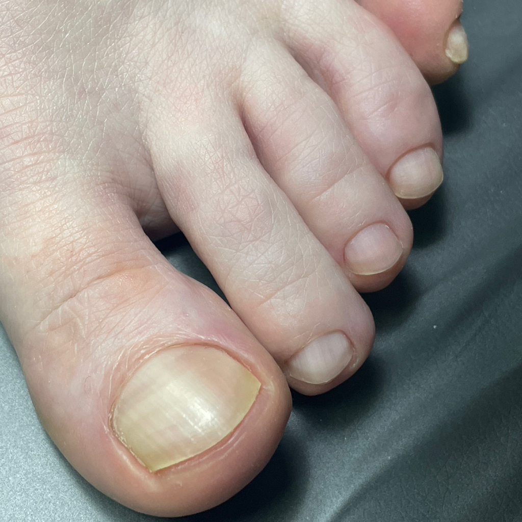 Педикюр без покрытия с обработкой только пальчиков