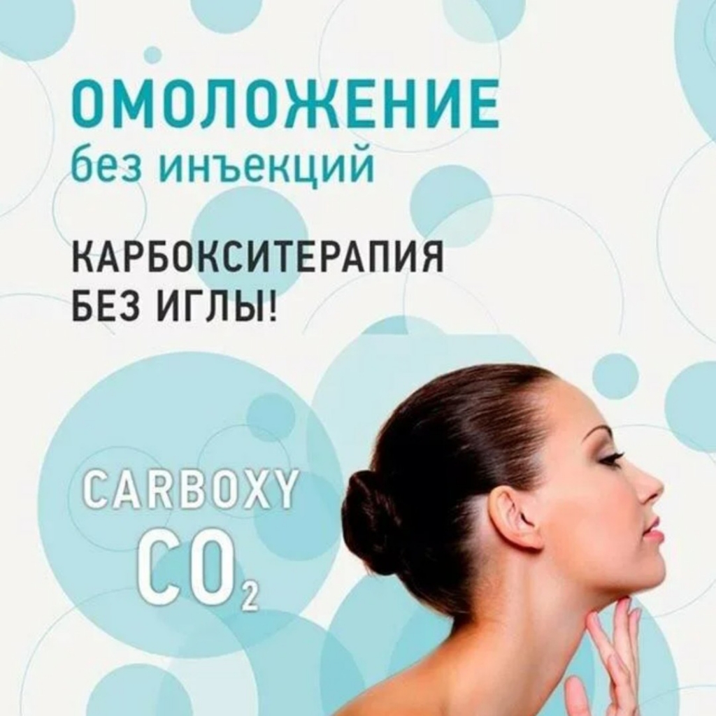 карбокситерапия