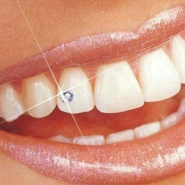 Установка скайса