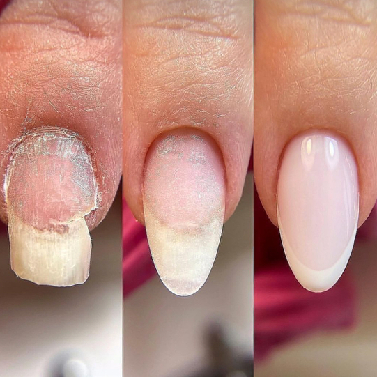 РЕМОНТ НОГТЯ