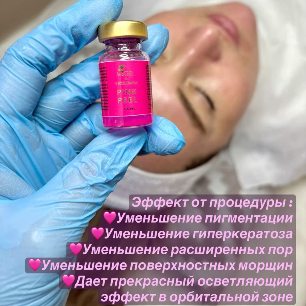Пилинг PINK PEEEL