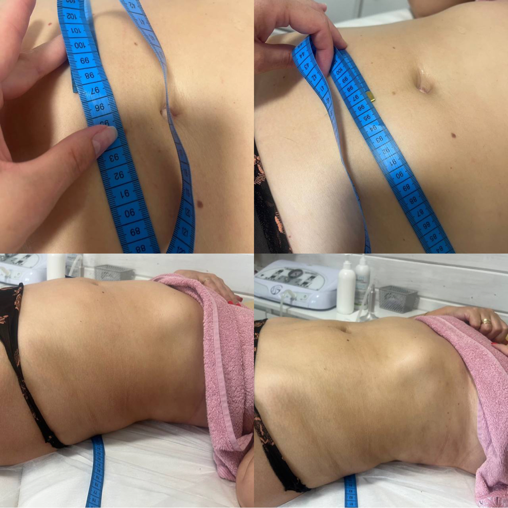 ОПЛАЧЕННЫЙ АБОНЕМЕНТ ‼️АКЦИЯ✅Любой аппаратный массаж (30 мин) тело/лицо