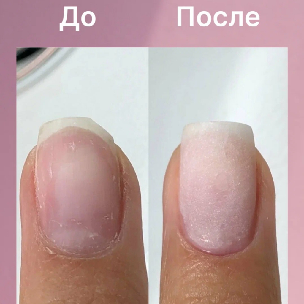 Ремонт ногтя