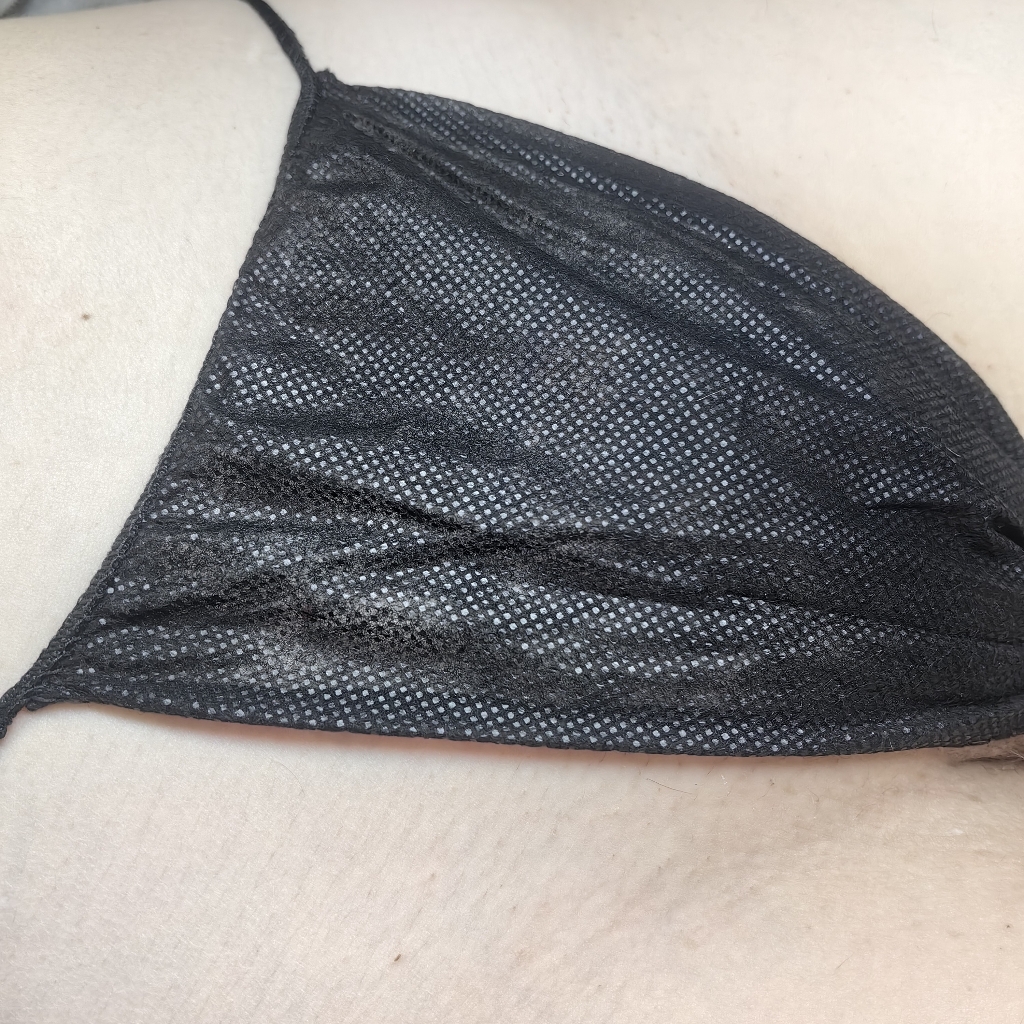 Электроэпиляция бикини