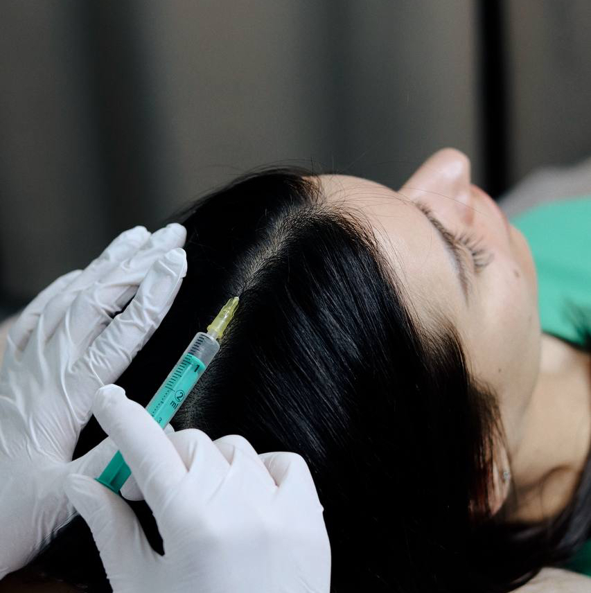 Мезотерапия кожи головы