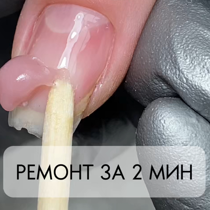 Ремонт ногтя