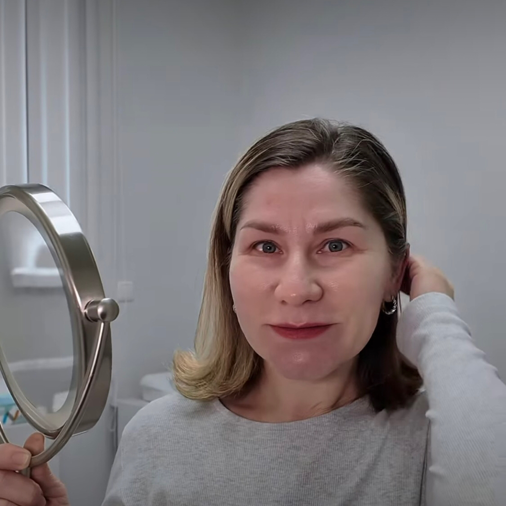 Биоревитализация Novacutan S-BIO / Y-Bio