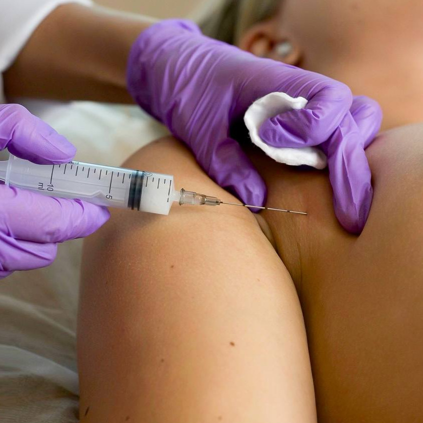 Увеличение груди филлером на основе полимолочной кислоты 1200 ml