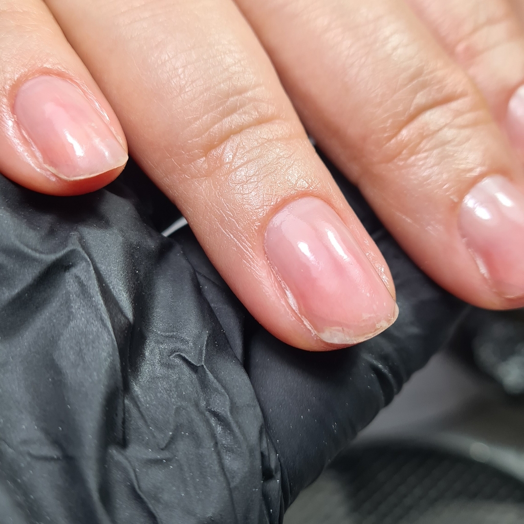 ЭКОГЛЯНЦЕВАНИЕ