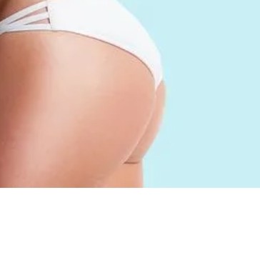 Лазерная эпиляция межьягодичная область