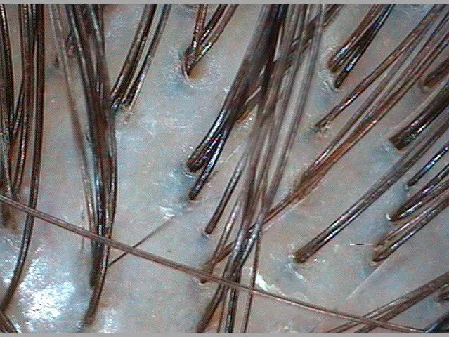пилинг кожи головы + SPA - увлажнение Dr. Sorbie на среднюю длину до лопаток