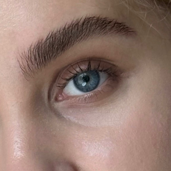 Удаление нежелательных волос воском над верхней губой