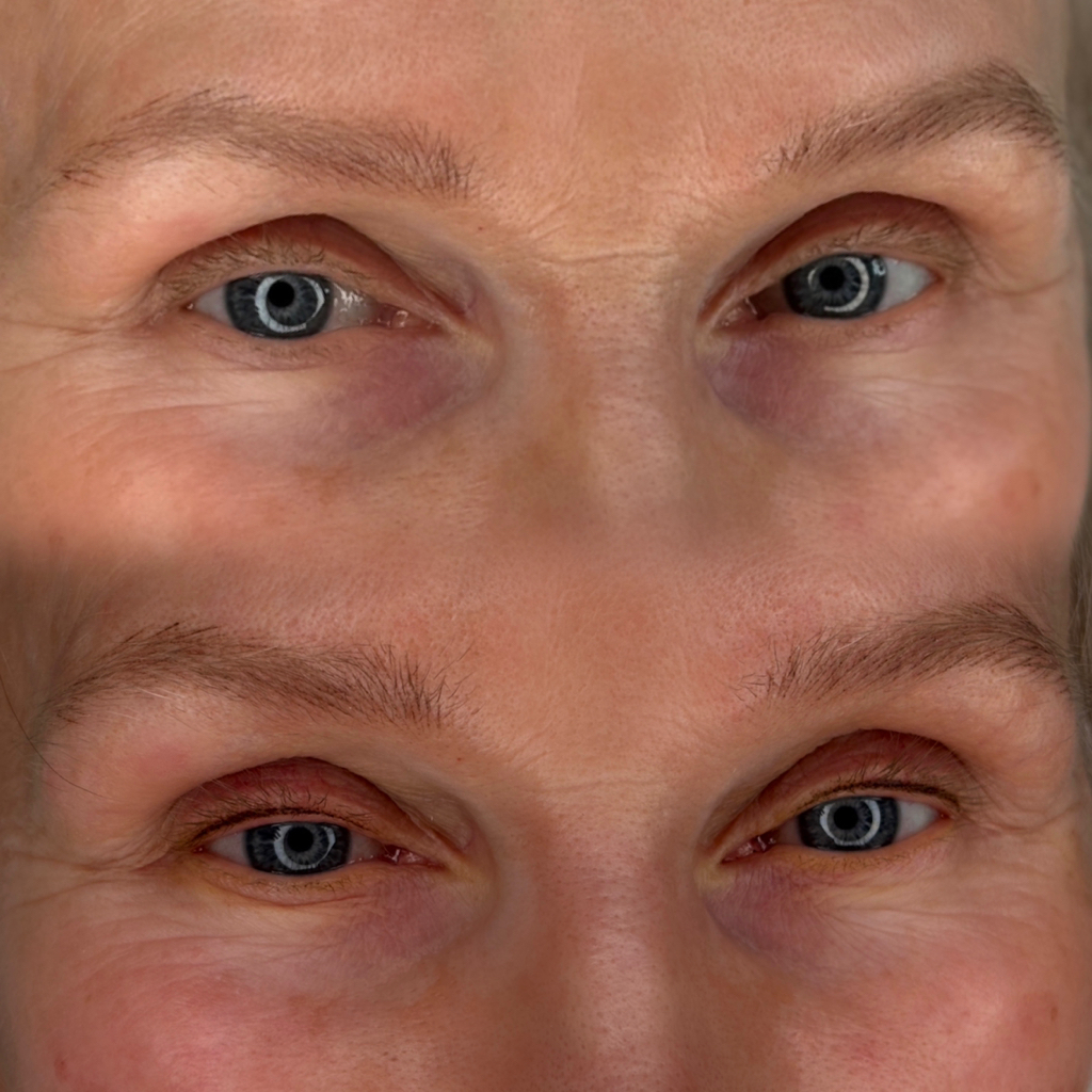 Перманент межресничного пространства