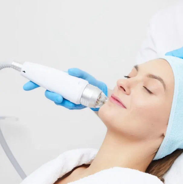 Микроигольчатый RF-лифтинг лица