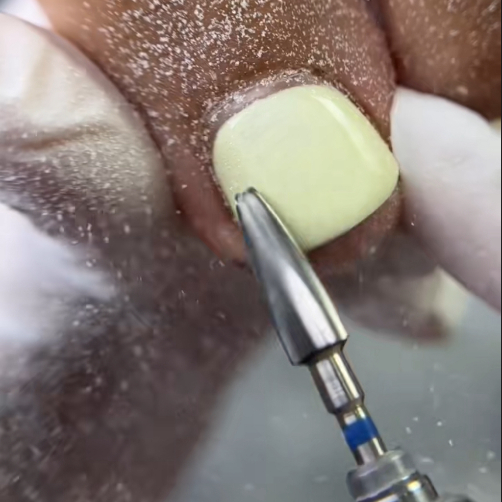 Снятие покрытия