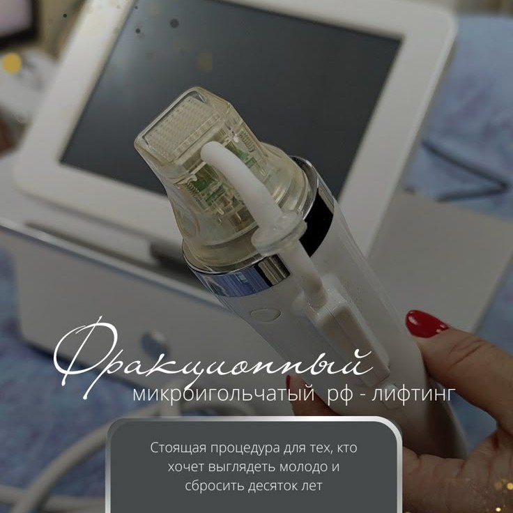 Микроигольчатый Rf-лифтинг живот