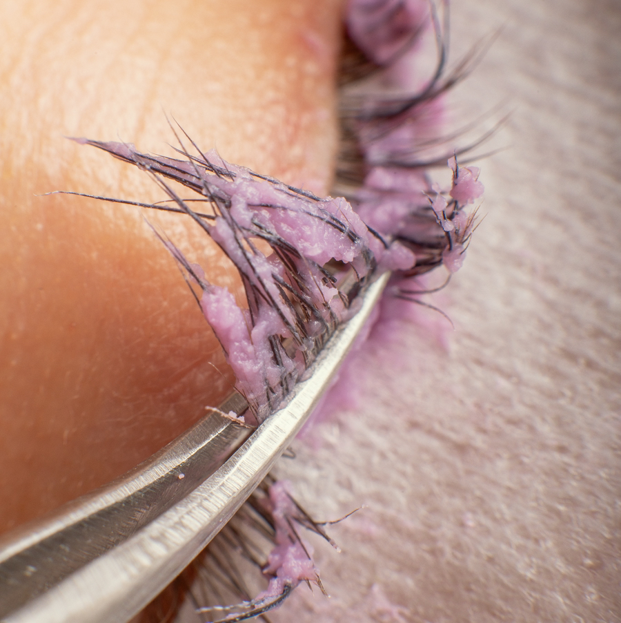 Снятие ресниц