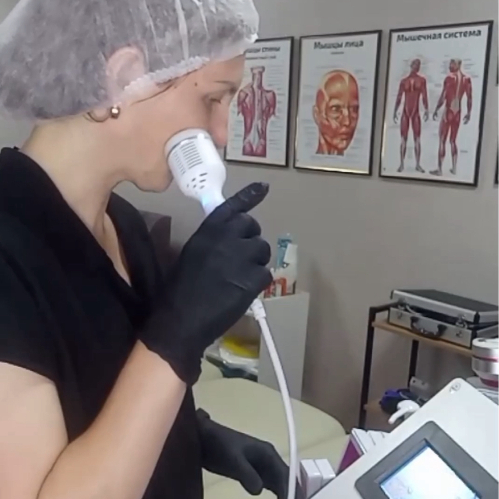 Криотерапия лица жидким азотом